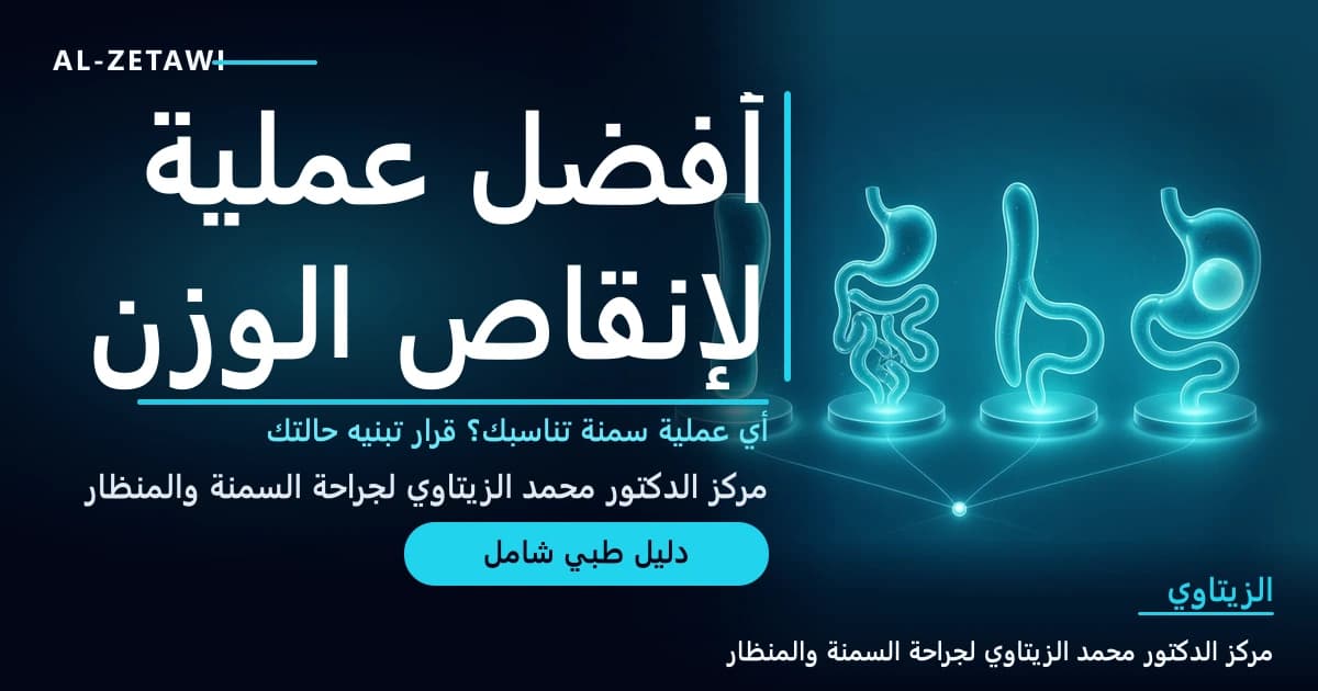 أفضل عملية لإنقاص الوزن: أي عملية سمنة تناسبني؟ — صورة مقال طبي | د. محمد عبد الوهاب الزيتاوي