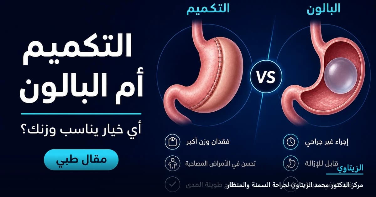 تكميم المعدة أم بالون المعدة: أي خيار يناسب وزنك؟ — رسم توضيحي لمقال طبي | د. محمد عبد الوهاب الزيتاوي