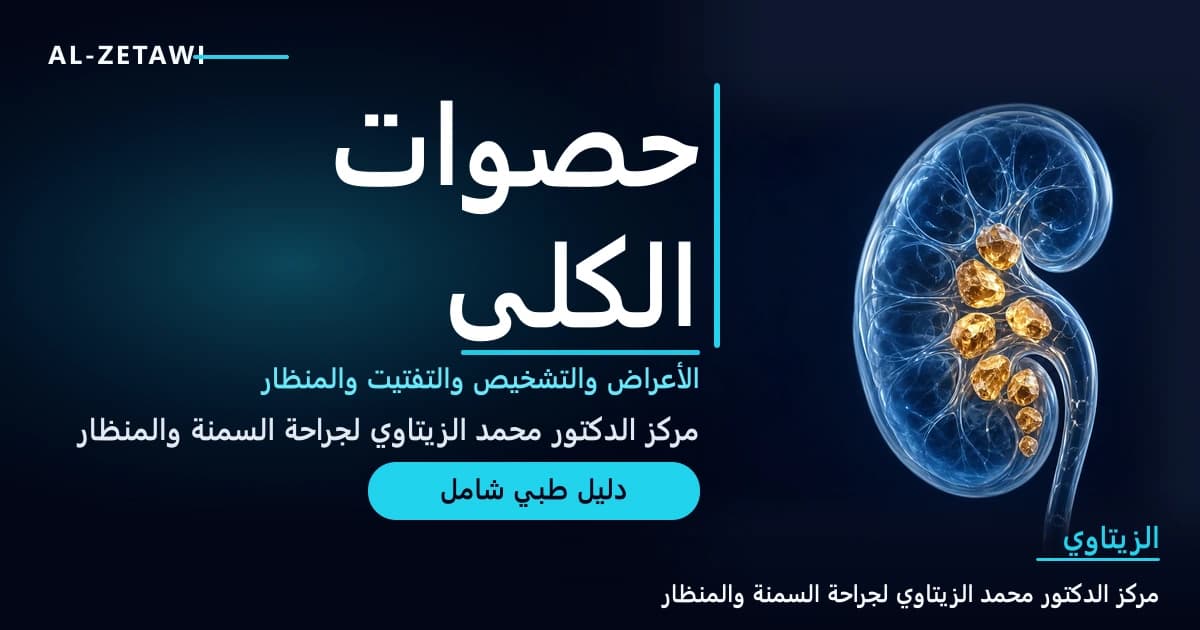 رسم طبي ثلاثي الأبعاد لكلية زجاجية شفافة زرقاء مع الحالب وفي داخلها حصوات بلورية ذهبية متوهجة — حصوات الكلى الأعراض والتشخيص والعلاج | د. محمد عبد الوهاب الزيتاوي