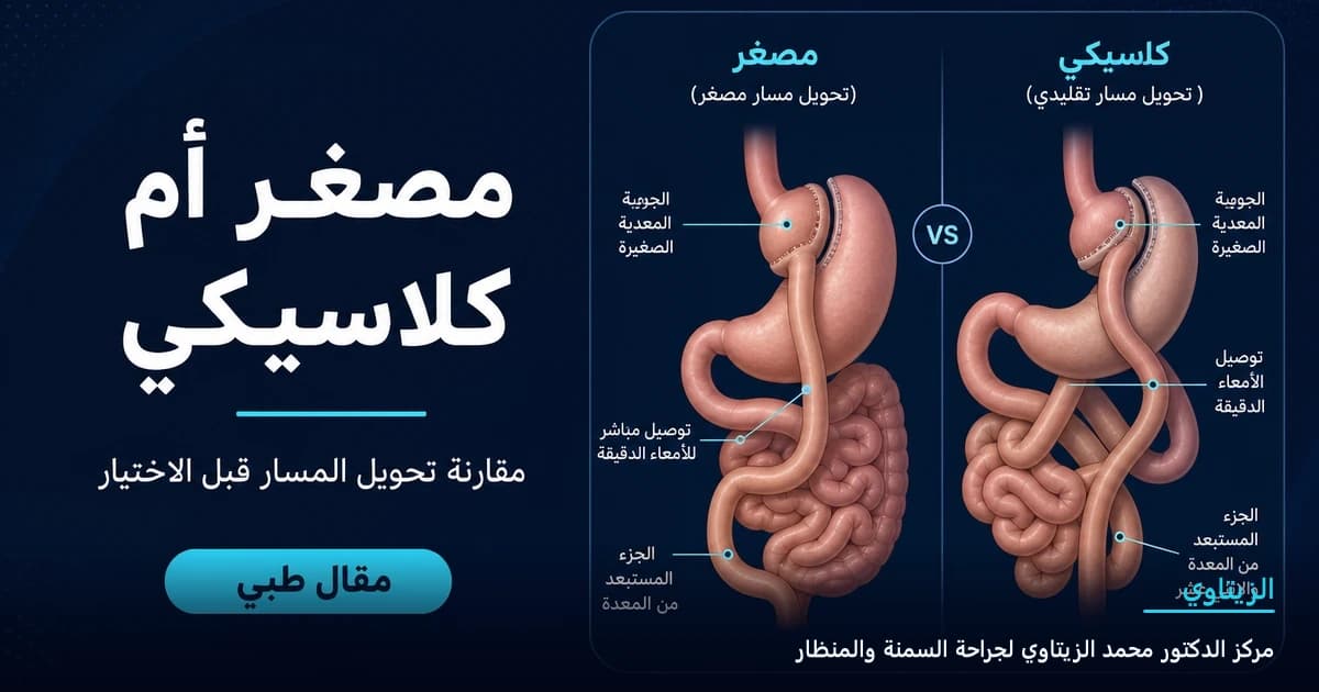 تحويل المسار المصغر أم الكلاسيكي: مقارنة قبل اختيار العملية — رسم توضيحي لمقال طبي | د. محمد عبد الوهاب الزيتاوي