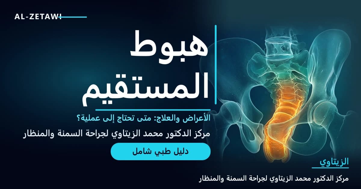 رسم طبي ثلاثي الأبعاد لحوض شفاف يظهر فيه المستقيم والقناة الشرجية مع جزء من جدار المستقيم مضيء باللون الكهرماني وهو ينزلق إلى الأسفل — هبوط المستقيم | د. محمد عبد الوهاب الزيتاوي
