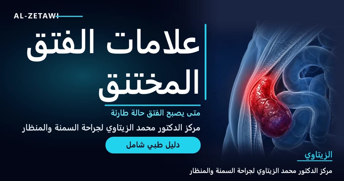 رسم طبي ثلاثي الأبعاد لعروة أمعاء محبوسة ومختنقة باللون الأحمر داخل فتق في جدار البطن — علامات الفتق المختنق | د. محمد عبد الوهاب الزيتاوي