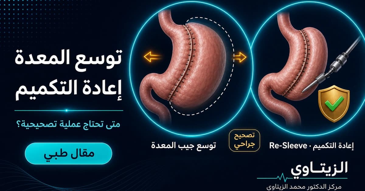 توسع المعدة اعادة التكميم — صورة مقال طبي | د. محمد عبد الوهاب الزيتاوي