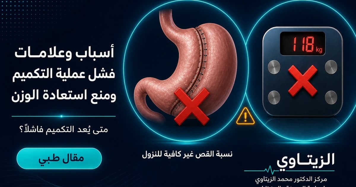 أسباب وعلامات فشل عملية التكميم ومنع استعادة الوزن — صورة مقال طبي | د. محمد عبد الوهاب الزيتاوي