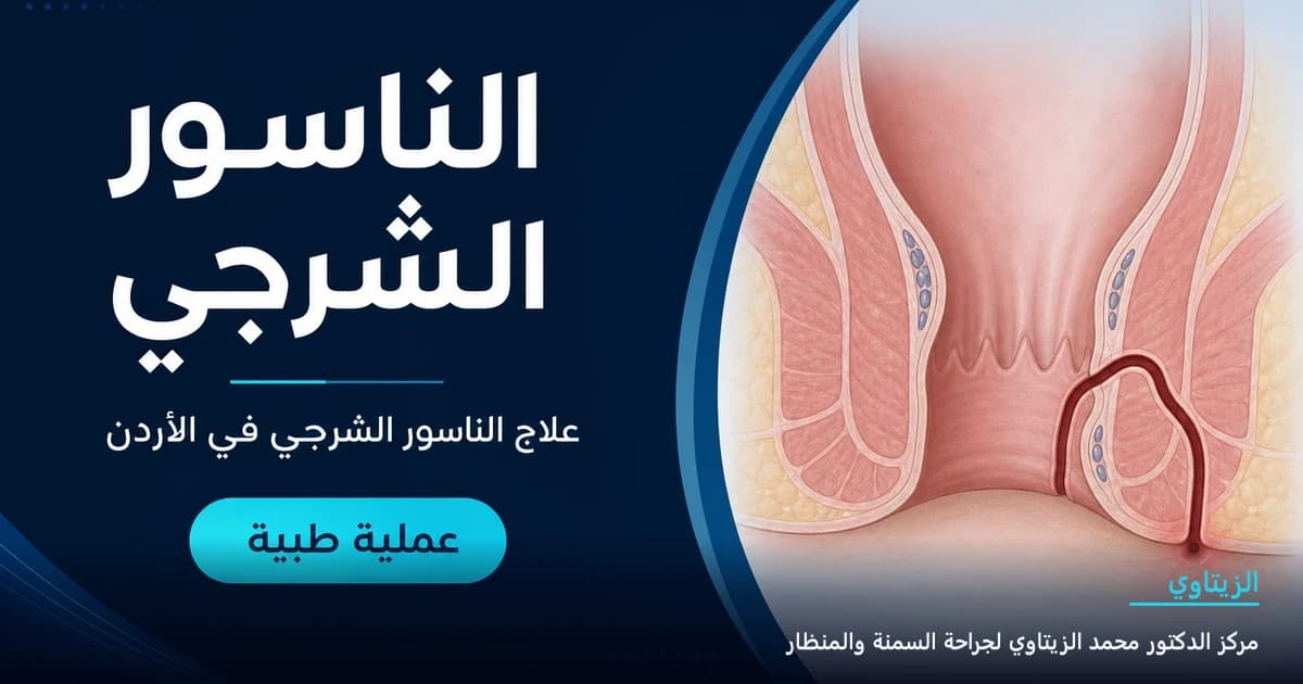 عملية الناسور الشرجي — علاج الناسور الشرجي في الأردن | د. محمد عبد الوهاب الزيتاوي