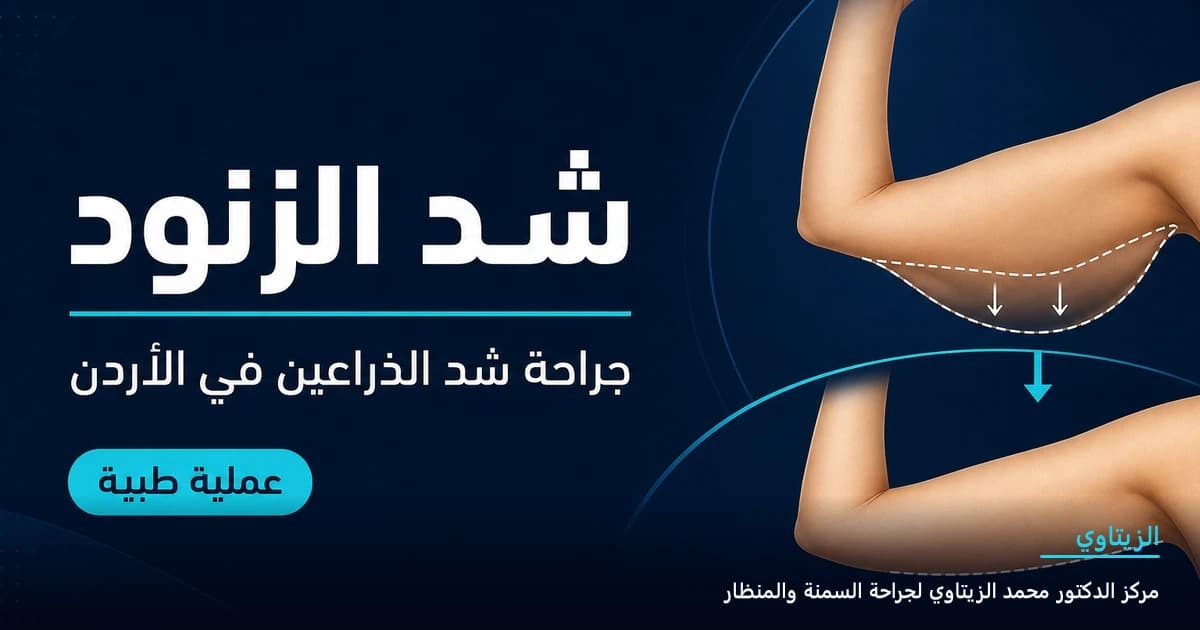 شد الزنود — رسم توضيحي للعملية في الأردن | د. محمد عبد الوهاب الزيتاوي