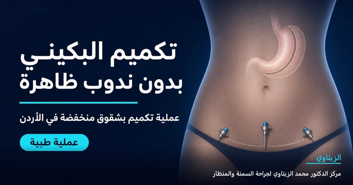 تكميم البكيني بدون ندوب ظاهرة — رسم توضيحي للعملية في الأردن | د. محمد عبد الوهاب الزيتاوي