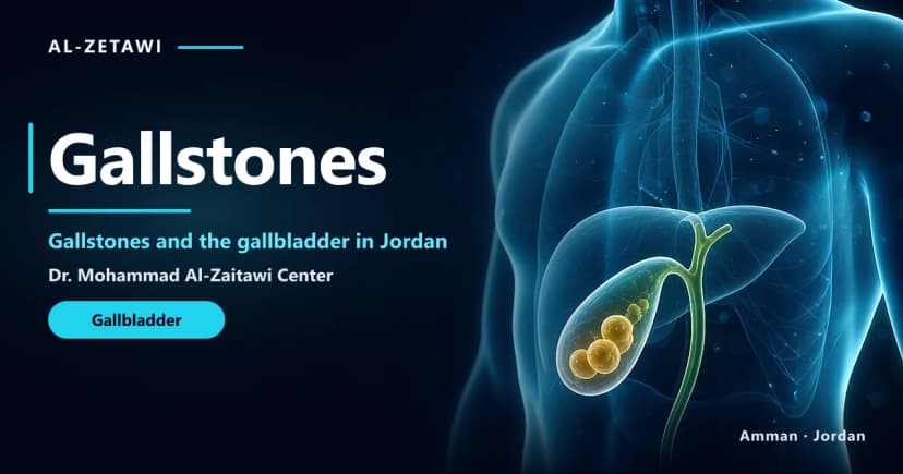 Gallstones