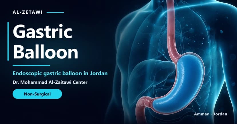 Gastric Balloon