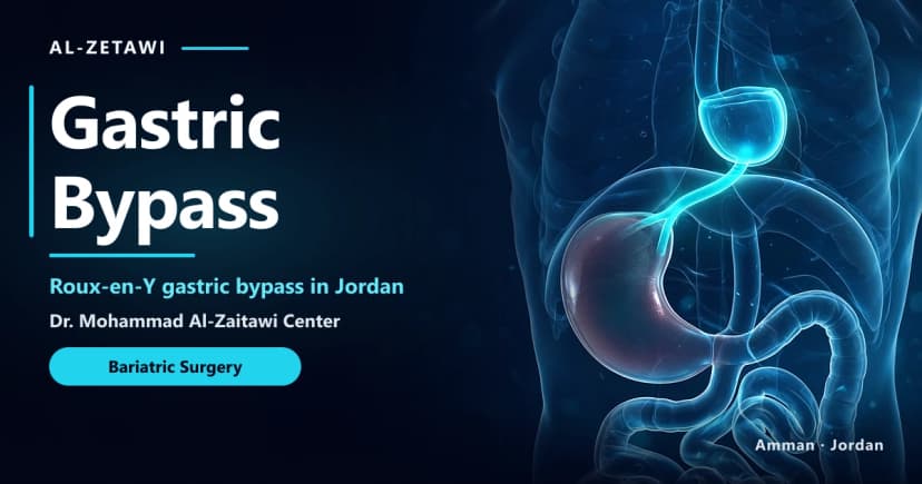 Gastric Bypass Surgery in Jordan