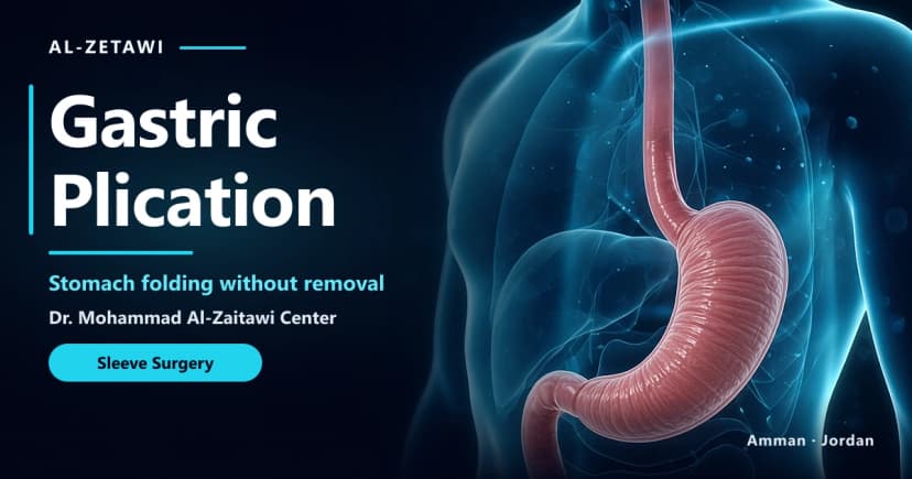Gastric Plication
