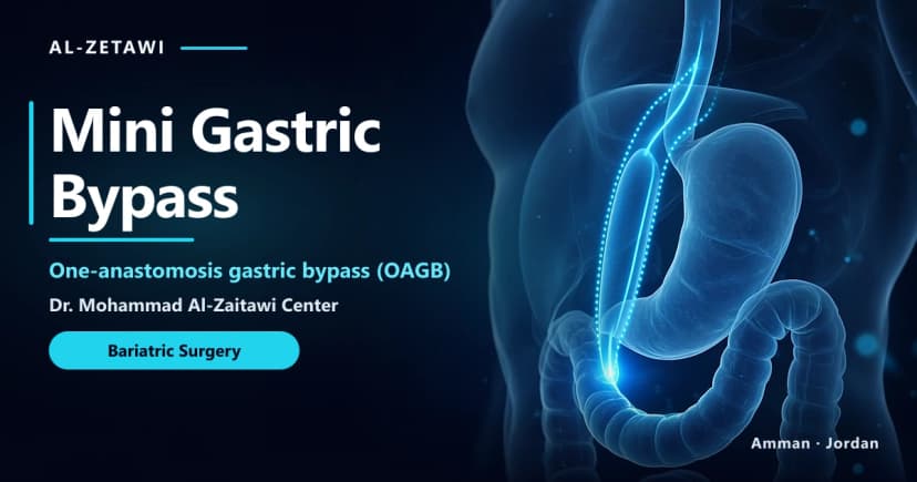 Mini Gastric Bypass in Jordan