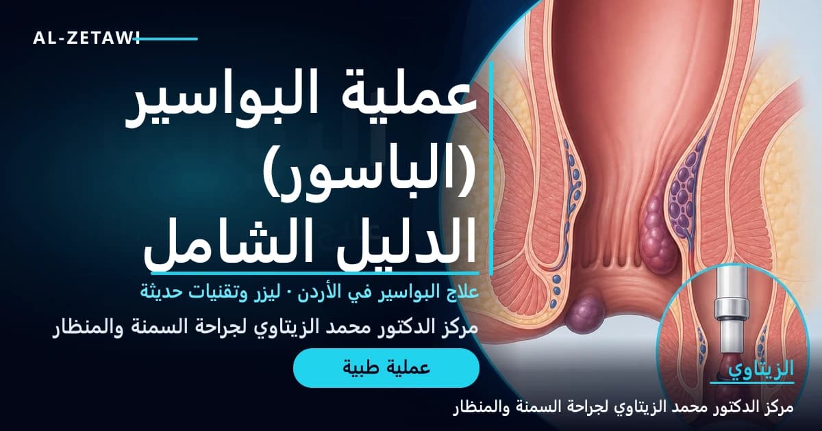 عملية البواسير (الباسور): الدليل الشامل — رسم توضيحي Ultra Premium لعلاج البواسير والباسور في الأردن | د. محمد عبد الوهاب الزيتاوي