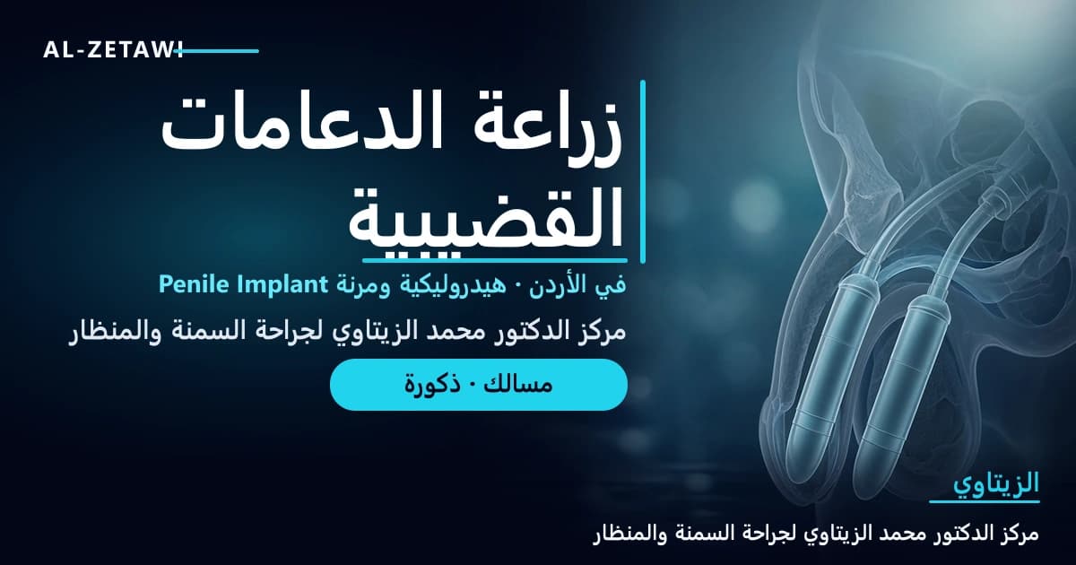 زراعة الدعامات القضيبية — رسم طبي Ultra Premium يوضح الدعامة الهيدروليكية Inflatable داخل الجسمين الكهفيين في الأردن | د. محمد عبد الوهاب الزيتاوي