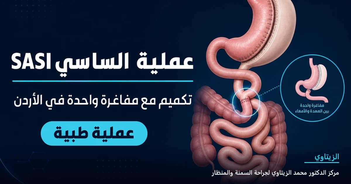 عملية الساسي SASI — رسم توضيحي للعملية في الأردن | د. محمد عبد الوهاب الزيتاوي