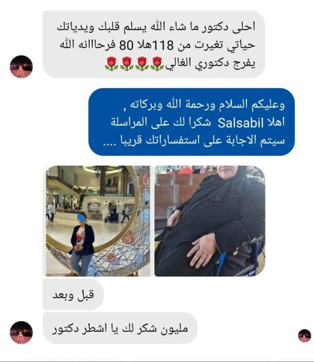 Salsabil's before and after message to Dr. Mohammad Al-Zaitawi: from 118 kg to 80 kg after bariatric surgery