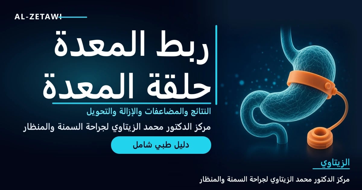 رسم طبي ثلاثي الأبعاد لمعدة شفافة تحيط بجزئها العلوي حلقة برتقالية متصلة بأنبوب وخزان صغير — ربط المعدة وحلقة المعدة | د. محمد عبد الوهاب الزيتاوي
