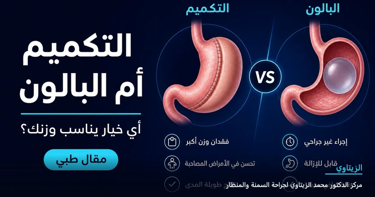 تكميم المعدة أم بالون المعدة: أي خيار يناسب وزنك؟ — رسم توضيحي لمقال طبي | د. محمد عبد الوهاب الزيتاوي
