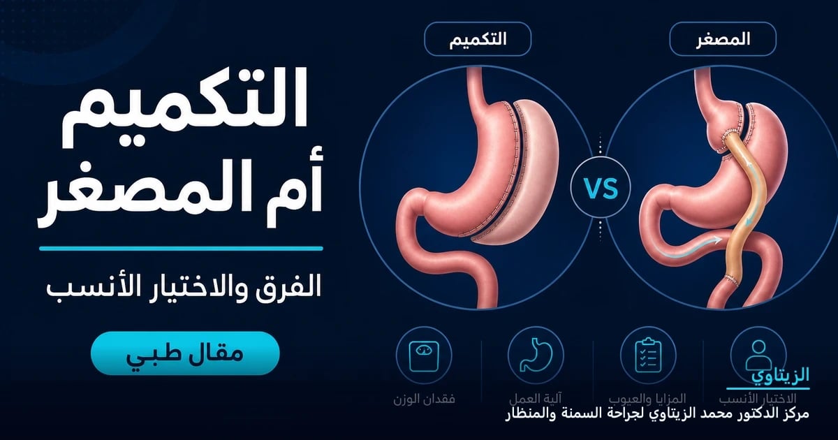 التكميم أم تحويل المسار المصغر: الفرق والاختيار الأنسب — رسم توضيحي لمقال طبي | د. محمد عبد الوهاب الزيتاوي