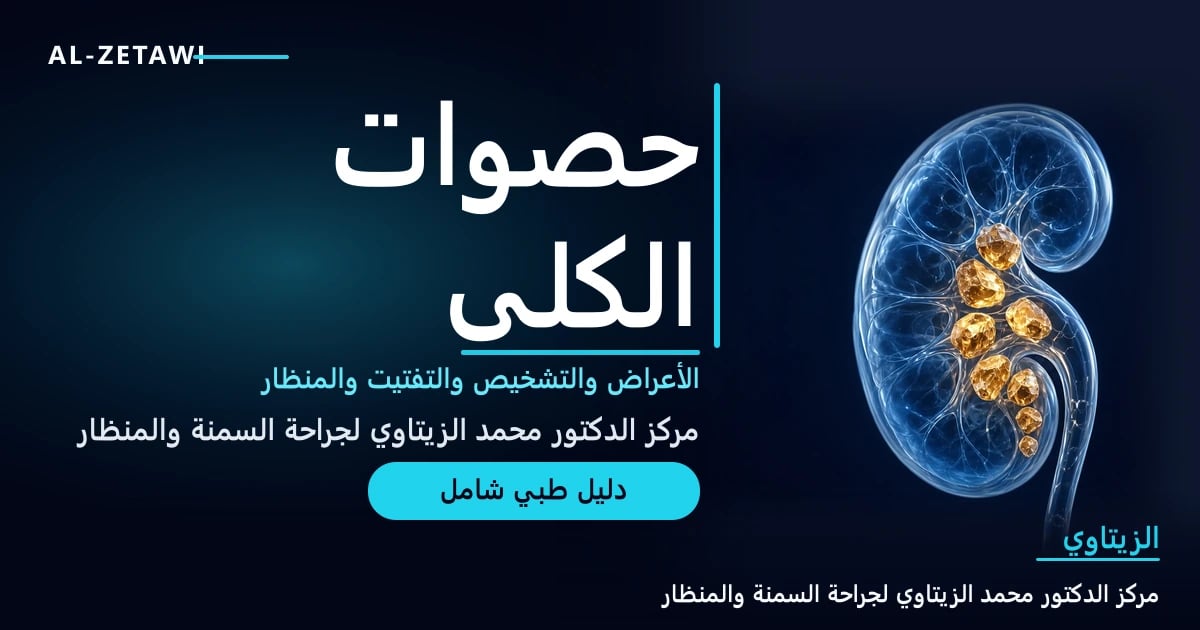 رسم طبي ثلاثي الأبعاد لكلية زجاجية شفافة زرقاء مع الحالب وفي داخلها حصوات بلورية ذهبية متوهجة — حصوات الكلى الأعراض والتشخيص والعلاج | د. محمد عبد الوهاب الزيتاوي