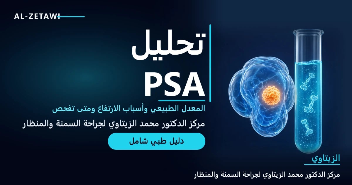 رسم طبي ثلاثي الأبعاد لبروستاتا زجاجية شفافة مع بقعة مضيئة صغيرة وأنبوب تحليل دم زجاجي — تحليل PSA وسرطان البروستاتا | د. محمد عبد الوهاب الزيتاوي