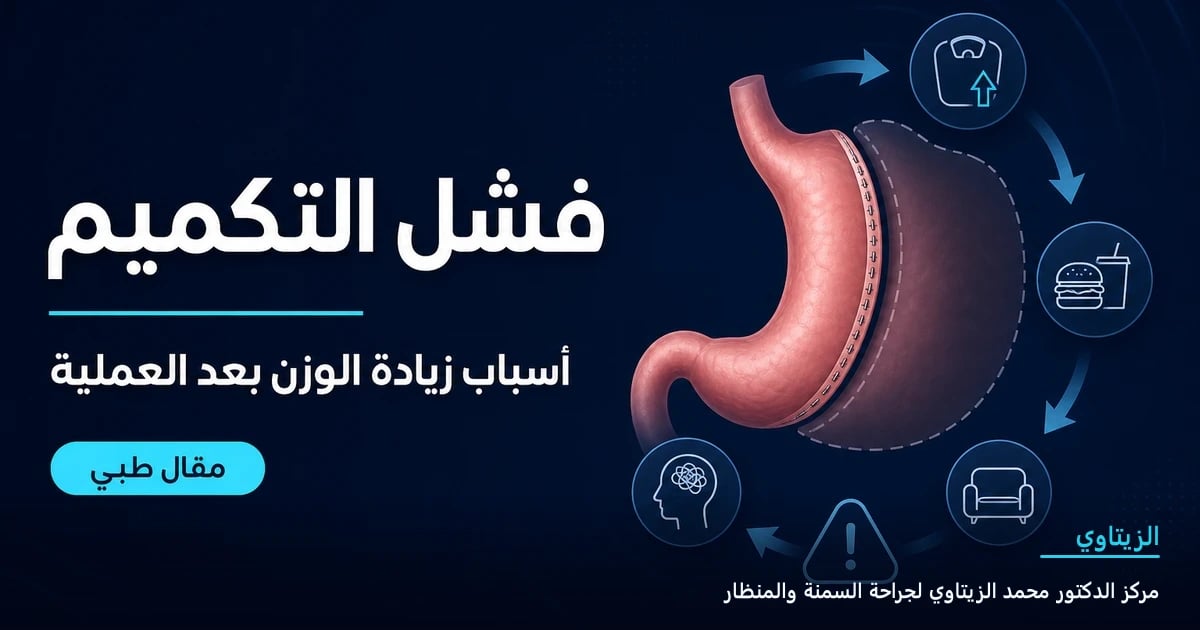 أسباب فشل عملية التكميم وكيفية تجنب زيادة الوزن — رسم توضيحي لمقال طبي | د. محمد عبد الوهاب الزيتاوي