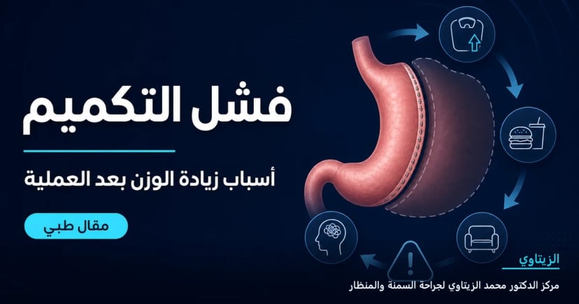 أسباب فشل عملية التكميم وكيفية تجنب زيادة الوزن — رسم توضيحي لمقال طبي | د. محمد عبد الوهاب الزيتاوي