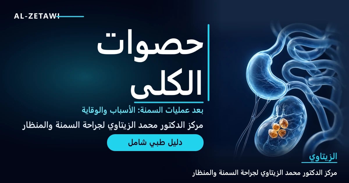 رسم طبي ثلاثي الأبعاد لمعدة مصغرة زجاجية شفافة متصلة بالأمعاء وتحتها كلية زجاجية تحتوي حصوات كهرمانية متوهجة — حصوات الكلى بعد عمليات السمنة | د. محمد عبد الوهاب الزيتاوي