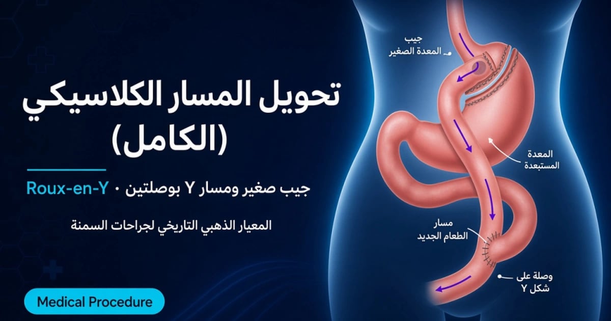 تحويل المسار الكلاسيكي