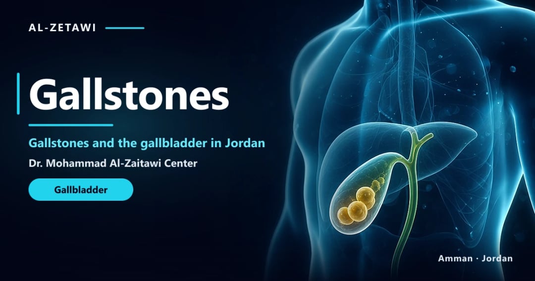 Gallstones in Jordan | Dr. Mohammad Al-Zaitawi Gallstones 3D illustration: yellow stones inside the gallbladder in Jordan