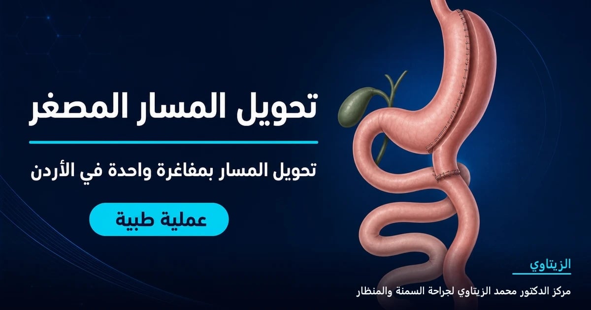 تحويل المسار المصغر