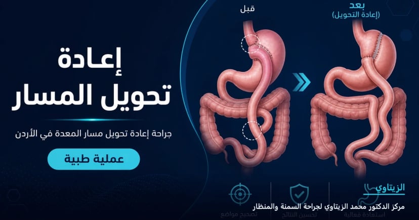 إعادة تحويل المسار — رسم توضيحي للعملية في الأردن | د. محمد عبد الوهاب الزيتاوي