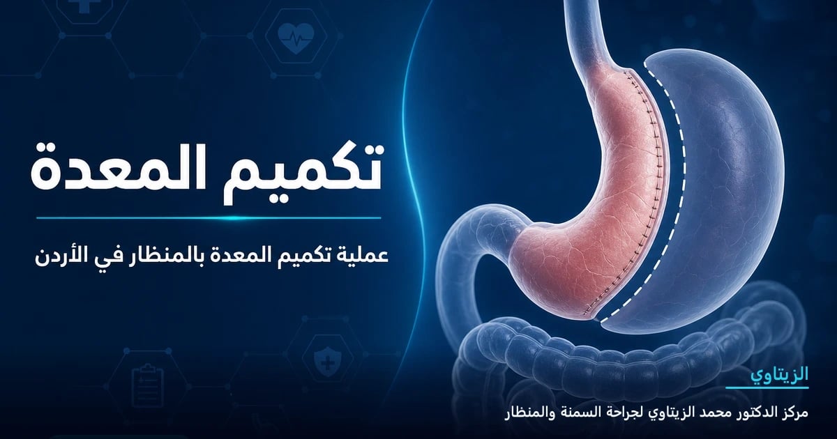 عملية تكميم المعدة