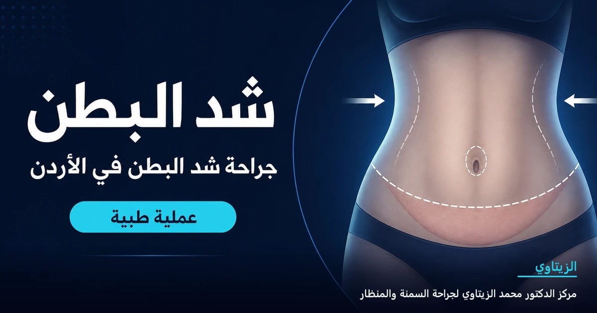عملية شد ترهلات البطن بعد نزول الوزن
