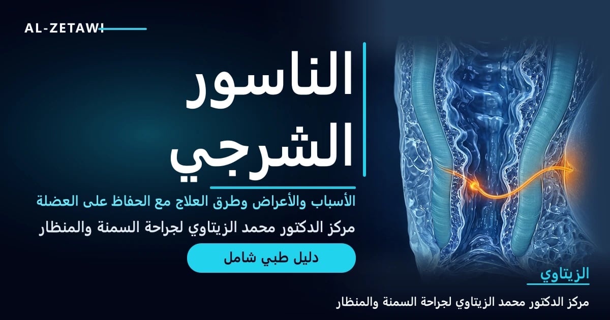 رسم طبي ثلاثي الأبعاد لمقطع في القناة الشرجية والعضلة العاصرة يظهر فيه مسار الناسور مضيئًا باللون البرتقالي — الناسور الشرجي | د. محمد عبد الوهاب الزيتاوي