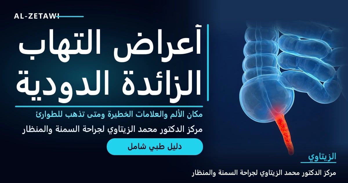 رسم طبي ثلاثي الأبعاد للأعور والزائدة الدودية الملتهبة باللون الأحمر — أعراض التهاب الزائدة الدودية | د. محمد عبد الوهاب الزيتاوي