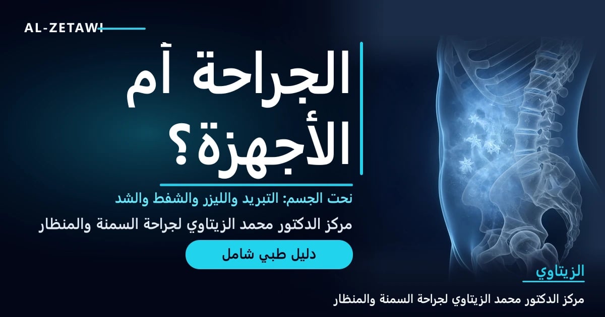 رسم طبي ثلاثي الأبعاد لجذع شفاف بأسلوب الأشعة مع توهج جليدي فوق البطن يرمز إلى تجميد الدهون وخط مضيء يحدد الخصر — نحت الجسم الجراحي وغير الجراحي | د. محمد عبد الوهاب الزيتاوي