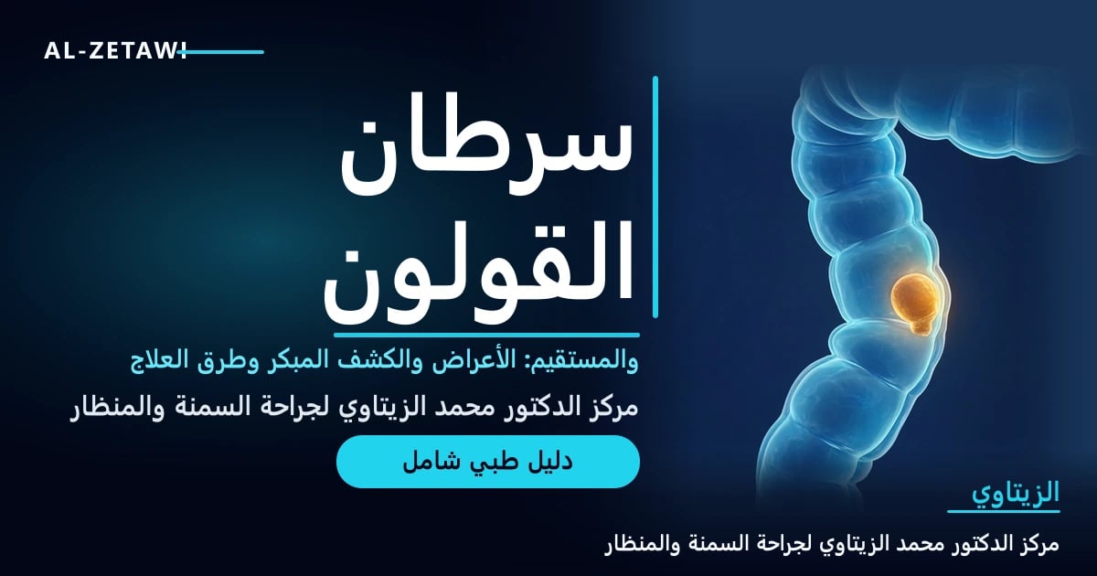 رسم طبي ثلاثي الأبعاد للقولون مع زائدة لحمية مضيئة يمكن اكتشافها بالمنظار — سرطان القولون والمستقيم والكشف المبكر | د. محمد عبد الوهاب الزيتاوي