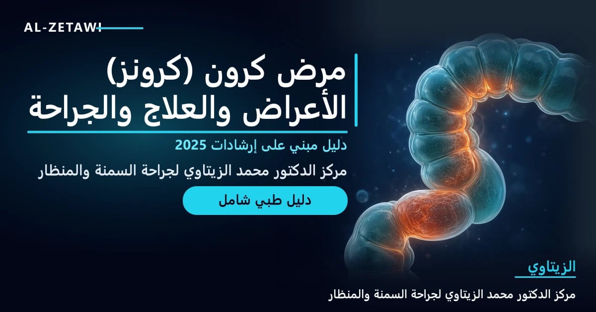 رسم طبي ثلاثي الأبعاد لأمعاء شفافة بلون فيروزي مع مناطق ملتهبة متوهجة بالبرتقالي تفصل بينها مناطق سليمة على خلفية كحلية — مرض كرون (كرونز): الأعراض والعلاج والجراحة | د. محمد عبد الوهاب الزيتاوي