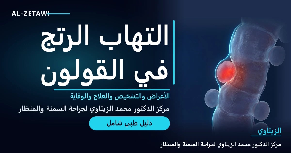 رسم طبي ثلاثي الأبعاد للقولون مع جيوب رتجية ملتهبة في القولون السيني — التهاب الرتج في القولون | د. محمد عبد الوهاب الزيتاوي