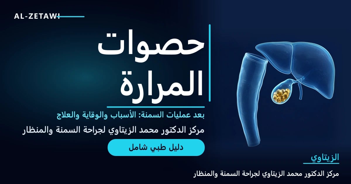 رسم طبي ثلاثي الأبعاد لمعدة مكممة بجانب الكبد والمرارة مع حصوات ذهبية — حصوات المرارة بعد عمليات السمنة | د. محمد عبد الوهاب الزيتاوي