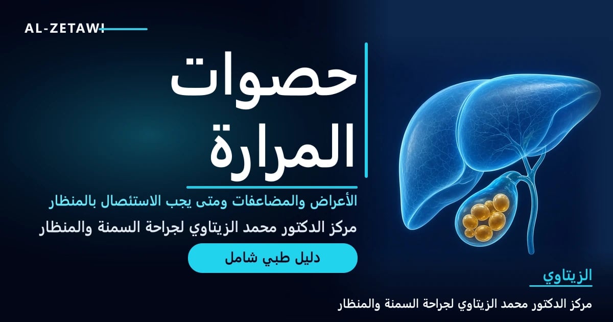 رسم طبي ثلاثي الأبعاد للكبد والمرارة مع حصوات ذهبية داخل المرارة — حصوات المرارة ومتى يجب الاستئصال | د. محمد عبد الوهاب الزيتاوي