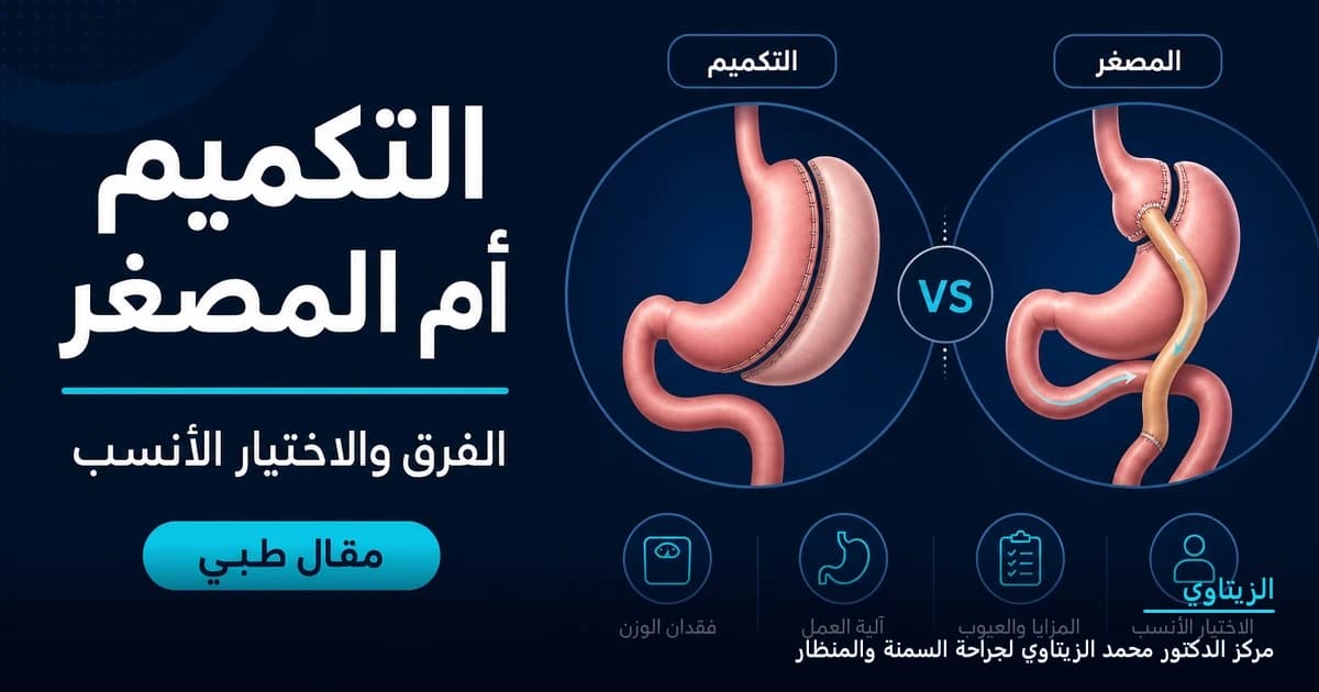 التكميم أم تحويل المسار المصغر: الفرق والاختيار الأنسب | د. محمد عبد الوهاب الزيتاوي التكميم أم تحويل المسار المصغر: الفرق والاختيار الأنسب — رسم توضيحي لمقال طبي | د. محمد عبد الوهاب الزيتاوي