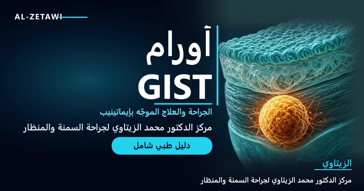 رسم طبي لمقطع عرضي في جدار المعدة يظهر فيه ورم دائري أملس مضيء ينمو من الطبقة العضلية — أورام GIST التشخيص والجراحة وإيماتينيب | د. محمد عبد الوهاب الزيتاوي