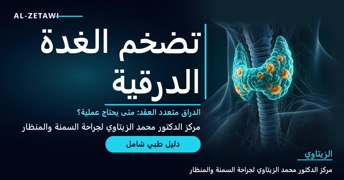 رسم طبي ثلاثي الأبعاد لغدة درقية متضخمة متعددة العقد مضيئة تضغط على القصبة الهوائية وتمتد إلى الأسفل خلف عظم القص — تضخم الغدة الدرقية (الدراق) | د. محمد عبد الوهاب الزيتاوي