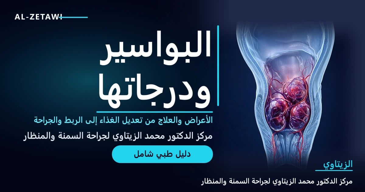 رسم طبي ثلاثي الأبعاد لمقطع في القناة الشرجية تظهر فيه وسائد البواسير الداخلية المتضخمة — البواسير الدرجات والعلاج | د. محمد عبد الوهاب الزيتاوي