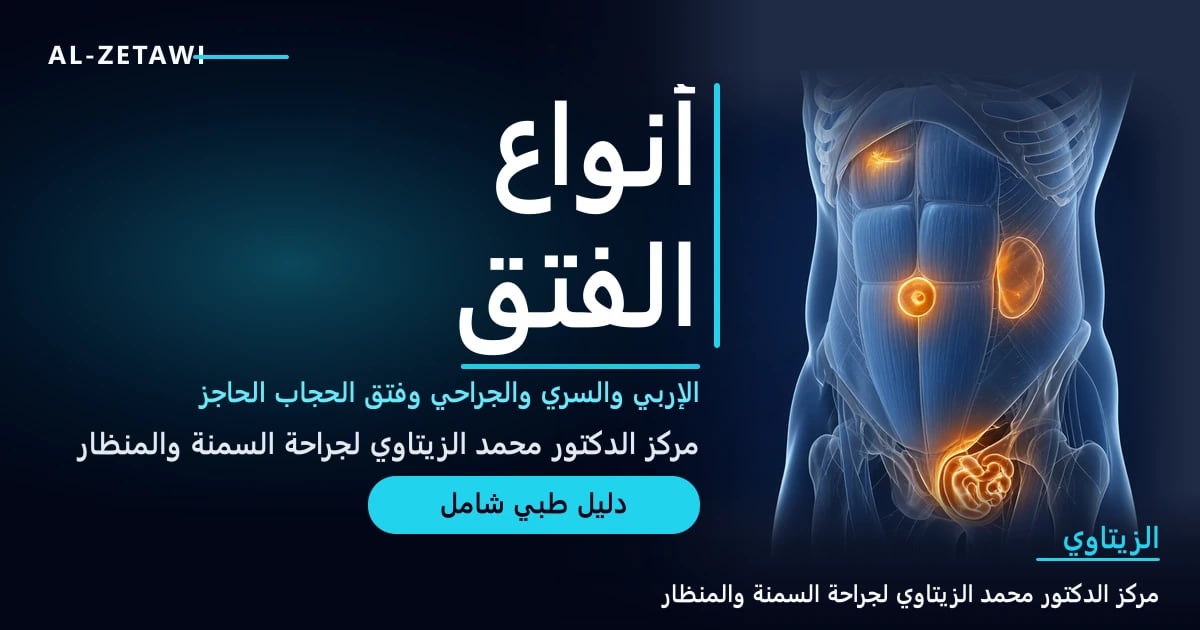 رسم طبي ثلاثي الأبعاد لجدار البطن مع أماكن الفتق الإربي والسري والجراحي وفتق الحجاب الحاجز مضيئة — أنواع الفتق | د. محمد عبد الوهاب الزيتاوي