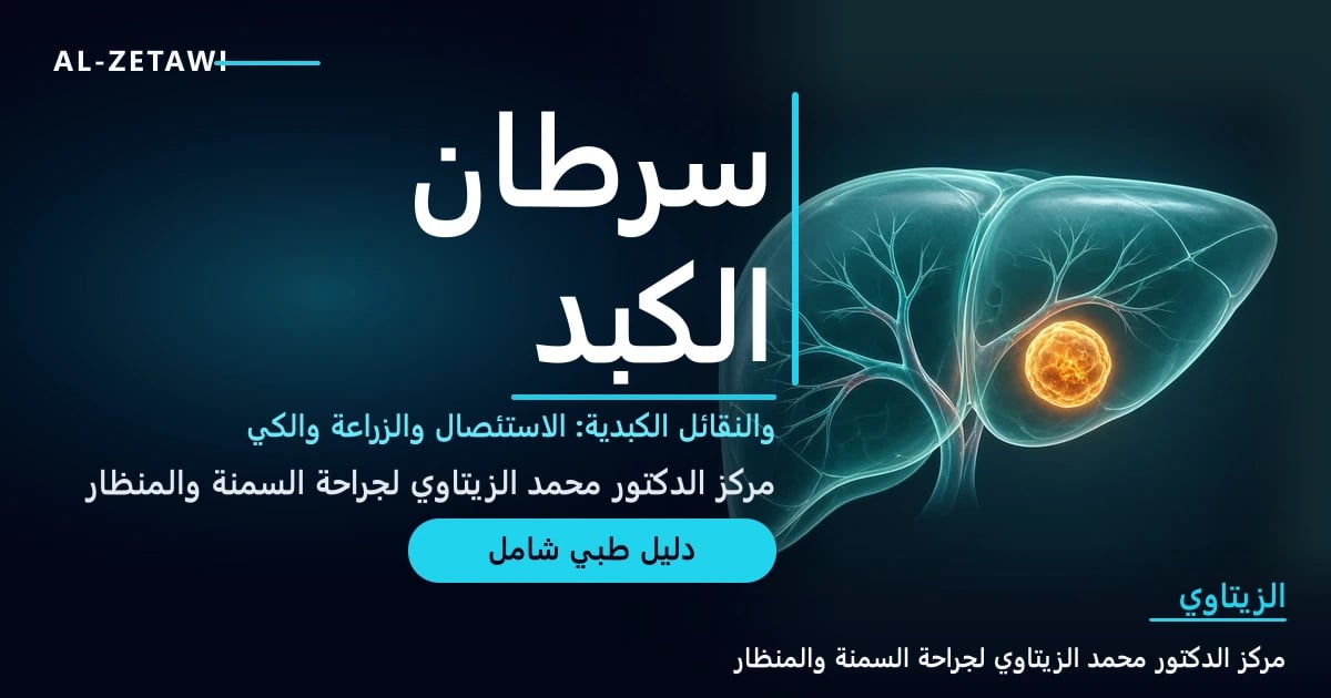 رسم طبي ثلاثي الأبعاد لكبد شفاف تظهر قطعه التشريحية مع قطعة واحدة متوهجة تمثل الورم — سرطان الكبد والنقائل الكبدية | د. محمد عبد الوهاب الزيتاوي