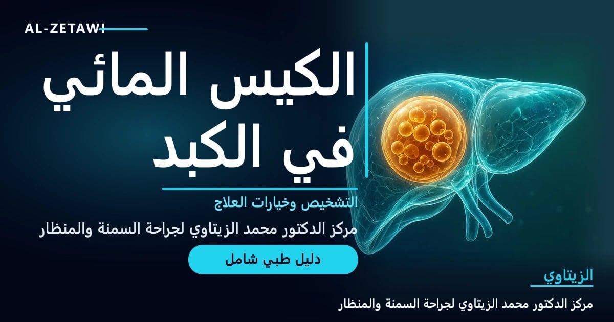رسم طبي ثلاثي الأبعاد لكبد شفاف بلون فيروزي يظهر فيه كيس دائري كبير متوهج بلون كهرماني يحتوي على أكياس بنات صغيرة — الكيس المائي في الكبد | د. محمد عبد الوهاب الزيتاوي