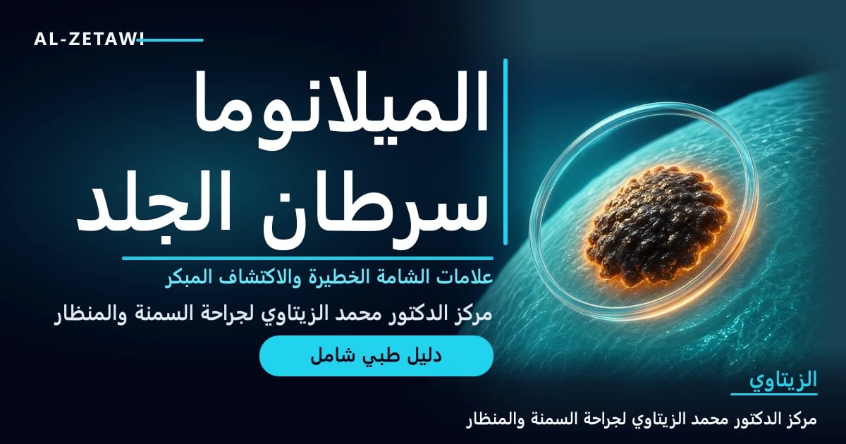 رسم طبي ثلاثي الأبعاد لمقطع جلد شفاف بطبقاته مع شامة داكنة غير منتظمة الحواف وخلايا صبغية مضيئة وعدسة مكبرة فوقها — الميلانوما: علامات الشامة الخطيرة | د. محمد عبد الوهاب الزيتاوي